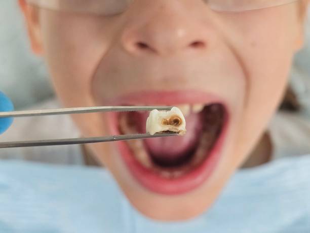 Best Same-Day Emergency Dentist in Coweta, OK